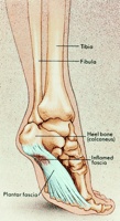 Heel Pain, Plantar Fasciitis | Masterton Foot Clinic, NZ diagram of heel 