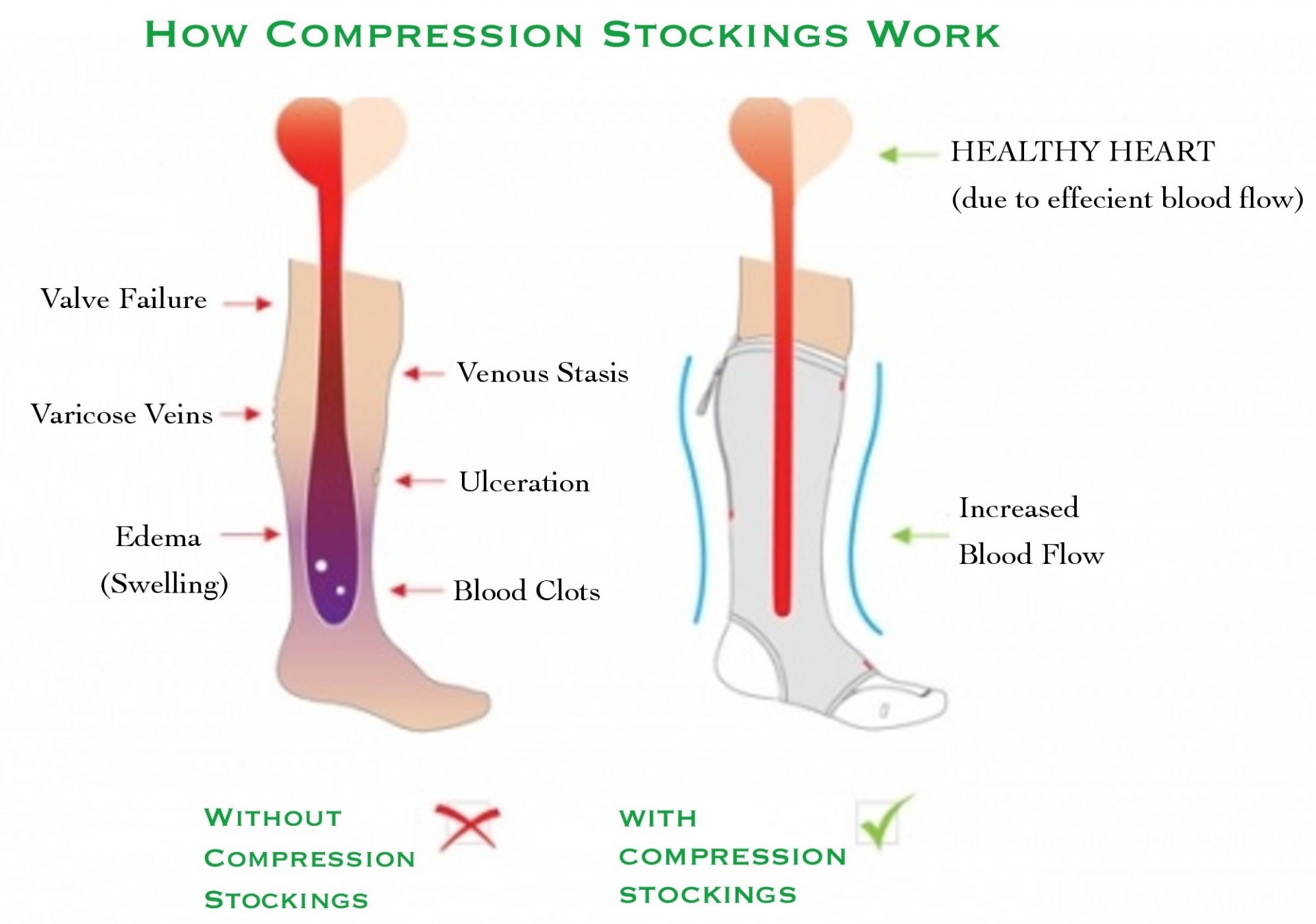 Compression Leggings, Socks & More