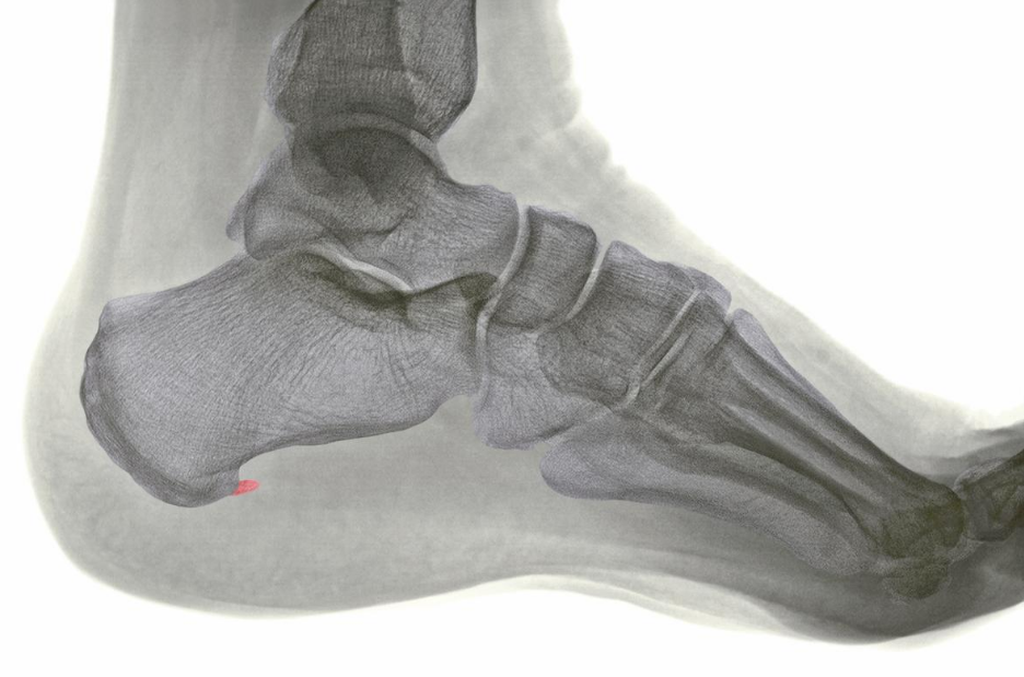 Dr Foot Gel Heel Cups Pair | Foot Comfort Support Protectors | For –  GlobalBees Shop