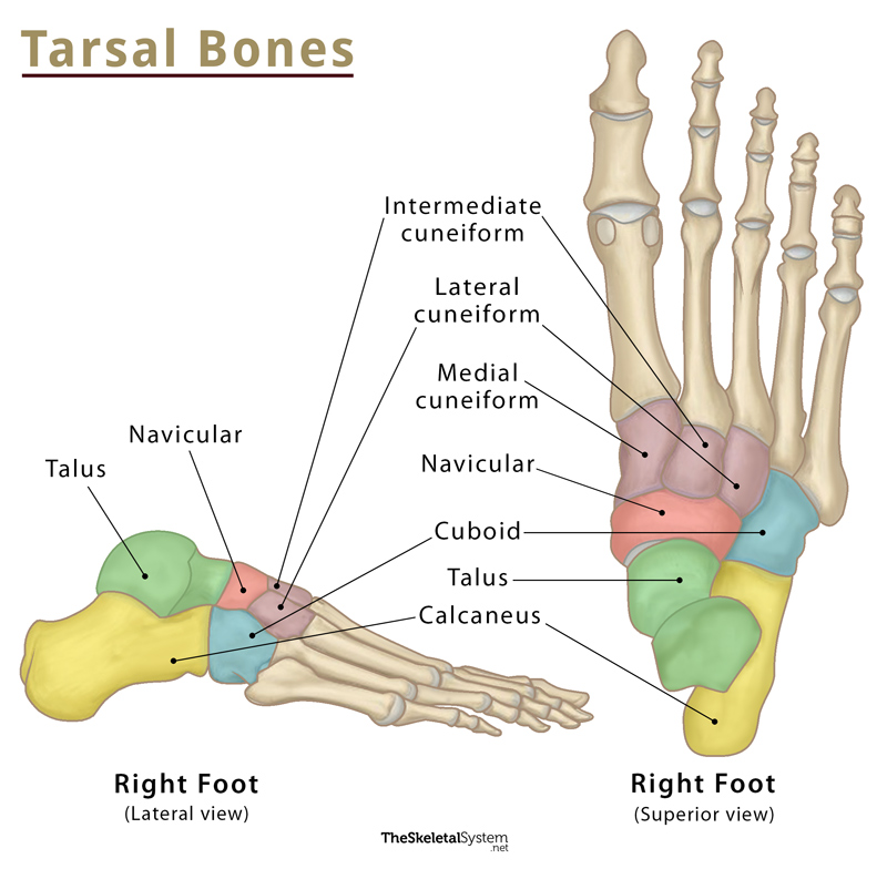 Tarsal Coalition