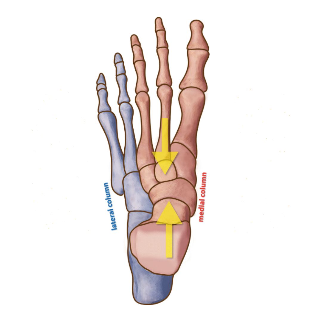 Lateral Column Overload lateral-column-overload