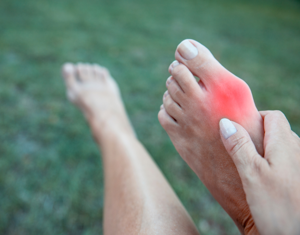 Ingrown Nail | Achilles Podiatry